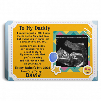 0.75'' Framed Canvas